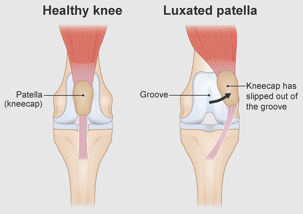 MPL Pathology