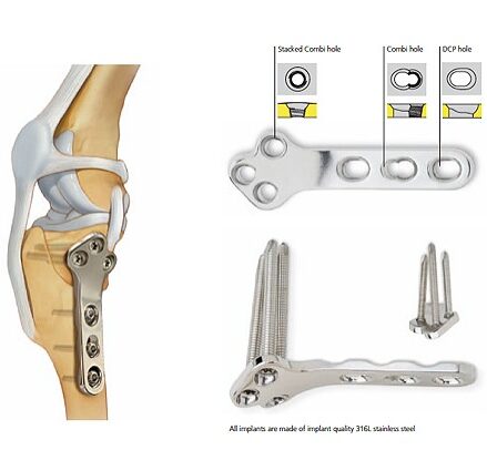 TPLO Diagram